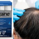 Minoxidil 5% : Tout ce que tu dois savoir sur ce traitement anti-chute